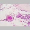 Medula osea HE 14.jpg